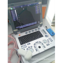Ultrasonido portátil CU18A de la máquina hecho por la última tecnología de Ultrason del color